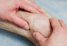 Collaflex – wsparcie dla stawów i sprawności ruchowej na każdym etapie życia staw kolanowy